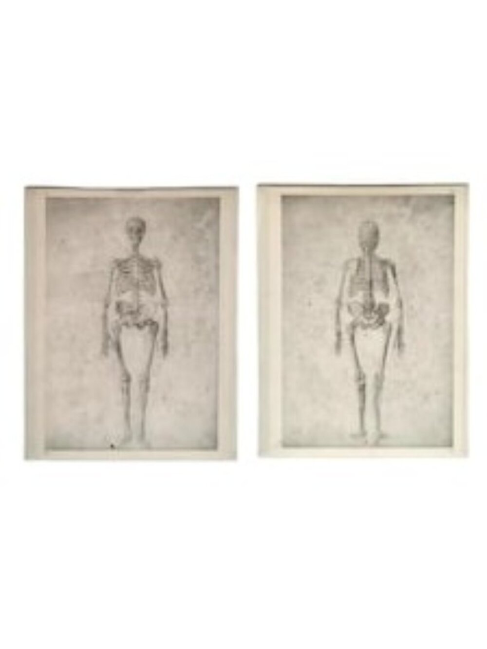 Skeleton Human Anatomy Vintage Print Acrylic Frame Pair Halloween Medical Decor
